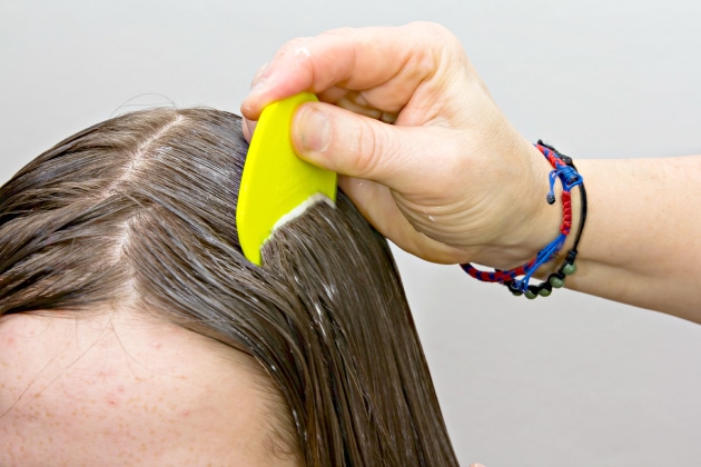 effective natural lice treatment